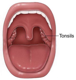 After Having Tonsils Removed Adults